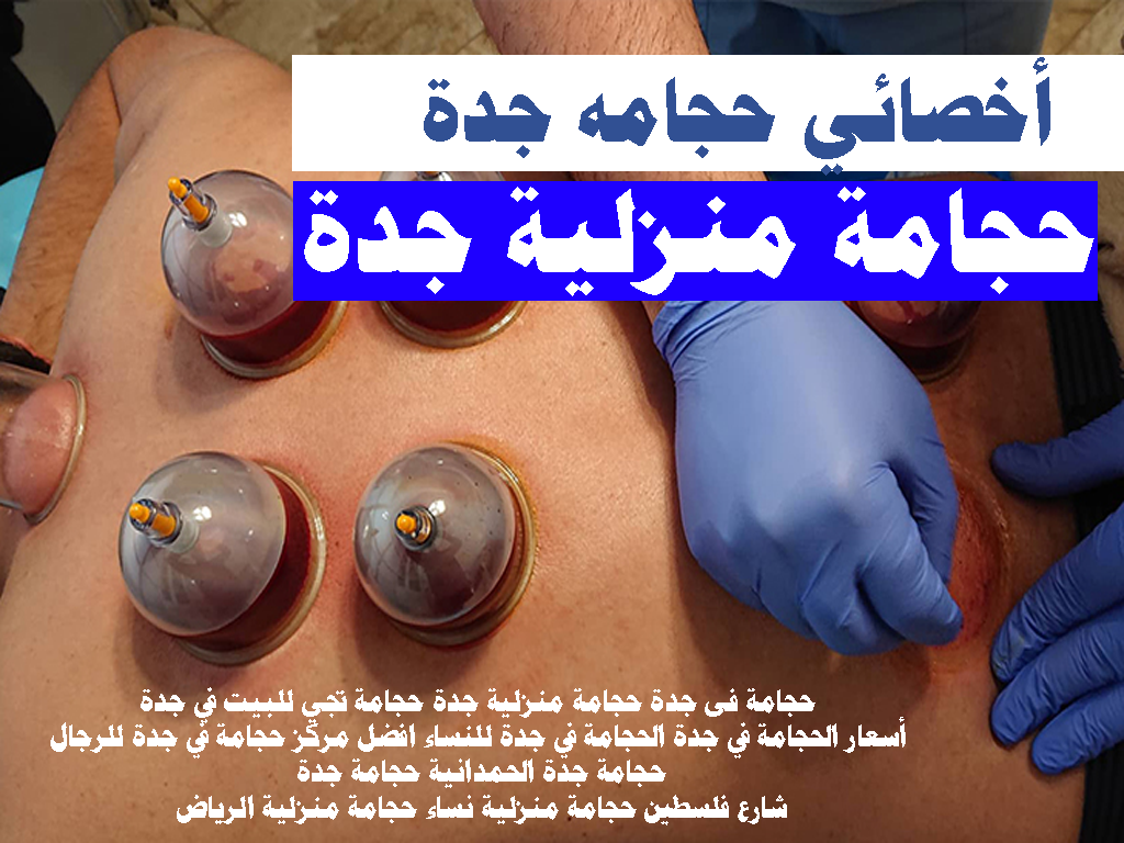 أخصائي حجامه جدة حجامة منزلية جدة